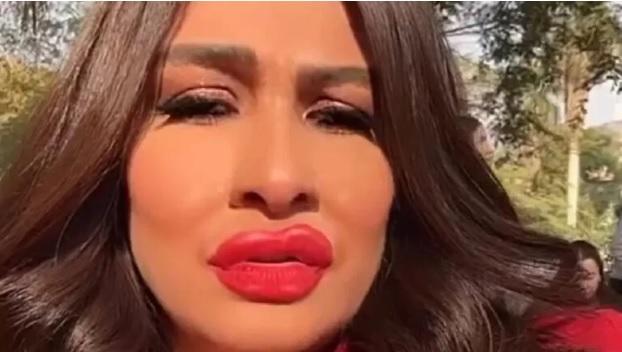 فيديو ..  ياسمين عبدالعزيز تفاجئ متابعيها بشفاه منتفخة