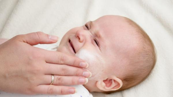 أسباب جفاف بشرة وجه الرضيع