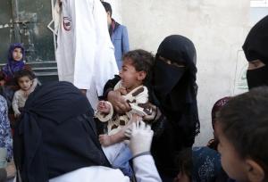 "الصحة العالمية": 50 ألف إصابة بالحصبة في اليمن خلال عام