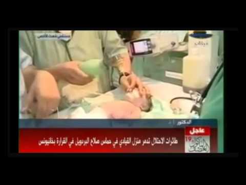 بالفيديو : إخراج جنين فلسطيني حي من بطن أمه الشهيدة