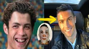 بالفيديو ..  هكذا كانت عمليات التجميل التي قام بها لاعبي كرة القدم 
