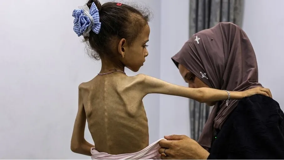 تحذيرات من مجاعة جديدة تهدد حياة الملايين في غزة
