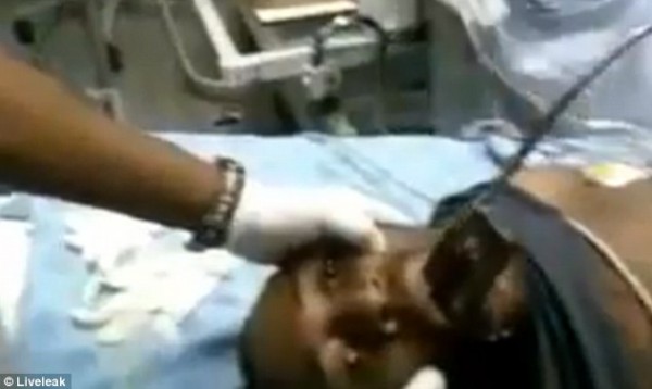 بالصور والفيديو  ..   عملية جراحية لازالة  "هاتف" من فم مريض !