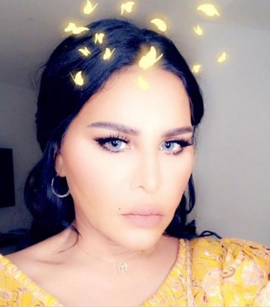 أحلام تُودع جمهورها: "هذه آخر صورة لي" ..  صورة 