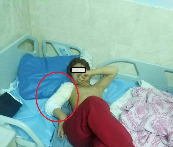 بعد نشر سرايا  ..  "التنمية" تحقق بحادثة كسر يد طفل مصاب بالتوحد في احد مراكز الرعاية بمحافظة عجلون 