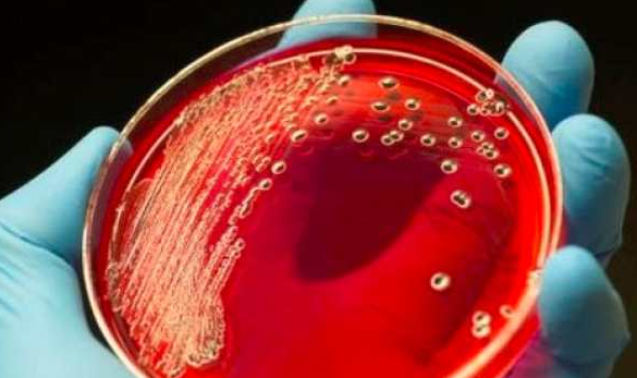 تعرّف على مرض التهاب الدم وأعراضه الخطيرة وطرق تشخيصه وعلاجه