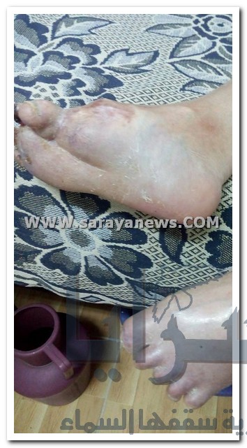 بالصور  ..  مسنون و ذوو احتياجات خاصة يعيشون حياة ملؤها القهر  ..  وقطع المعونات عنهم أصبحت " هواية "