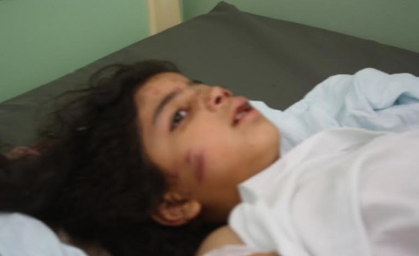 سجى زعرب من رفح تسأل : وين ماما ؟
