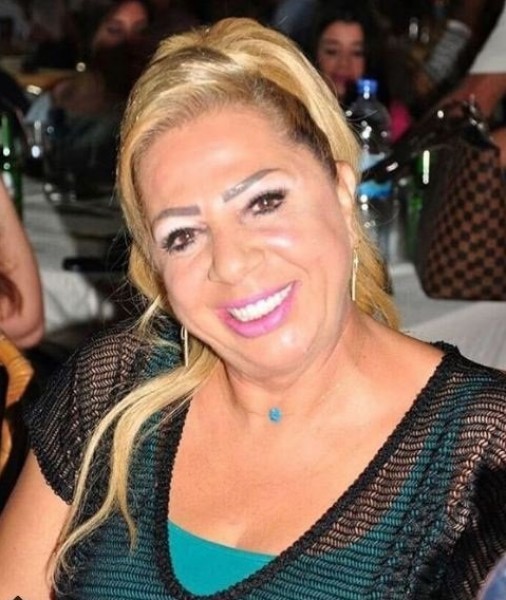 بالصور .. تغييرات جذرية في شكل غادة بشور  ..  هل هي عمليات التجميل؟ 