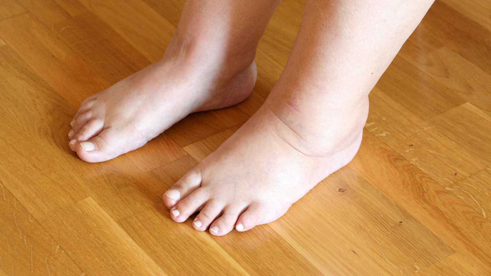 كيف نميز بين زيادة الوزن واحتباس السوائل في الجسم؟ 