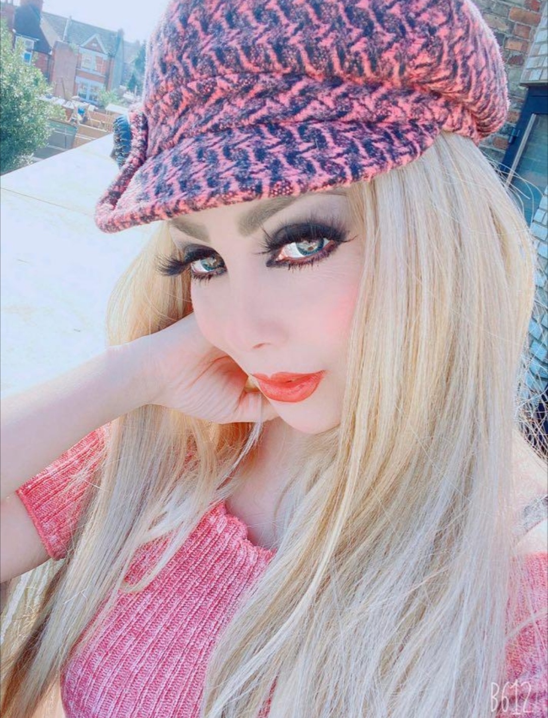 هل الإرث الجيني قدر مقدّر لا مفرّ منه ؟