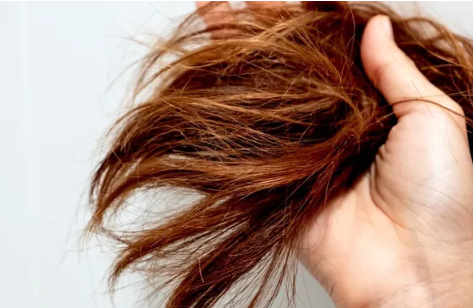 مع حرارة الصيف ..  5 خطوات بسيطة تمنع تساقط الشعر وتعزز نموه
