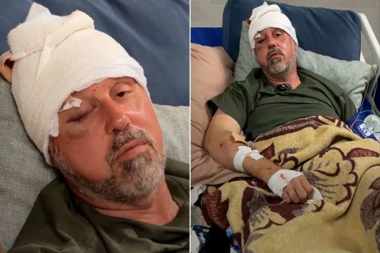 200 غرزة في رأسه ..  مستوطنون يعتدون على فلسطيني أمريكي بالضفة
