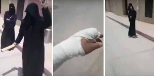 بالفيديو  ..  فتاة تكسر يد أبيها لسبب غريب  ..  تثير جدلا واسعا على مواقع التواصل الاجتماعي 