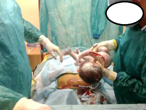 تعنت الاطباء في مستشفى حكومي يتسبب بوفاة مولودة و انفجار رحم والدتها رغم توسل الأم للطبيب ..  تفاصيل مؤلمة