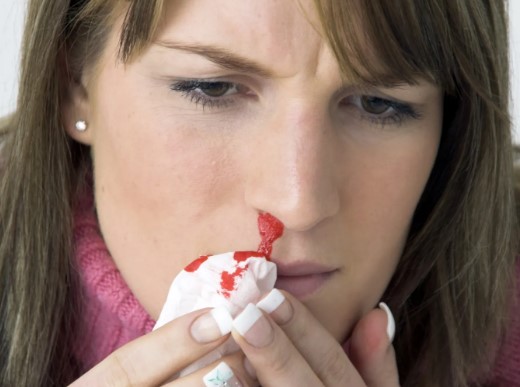 ما هي متلازمة "فون ويلبراند"؟