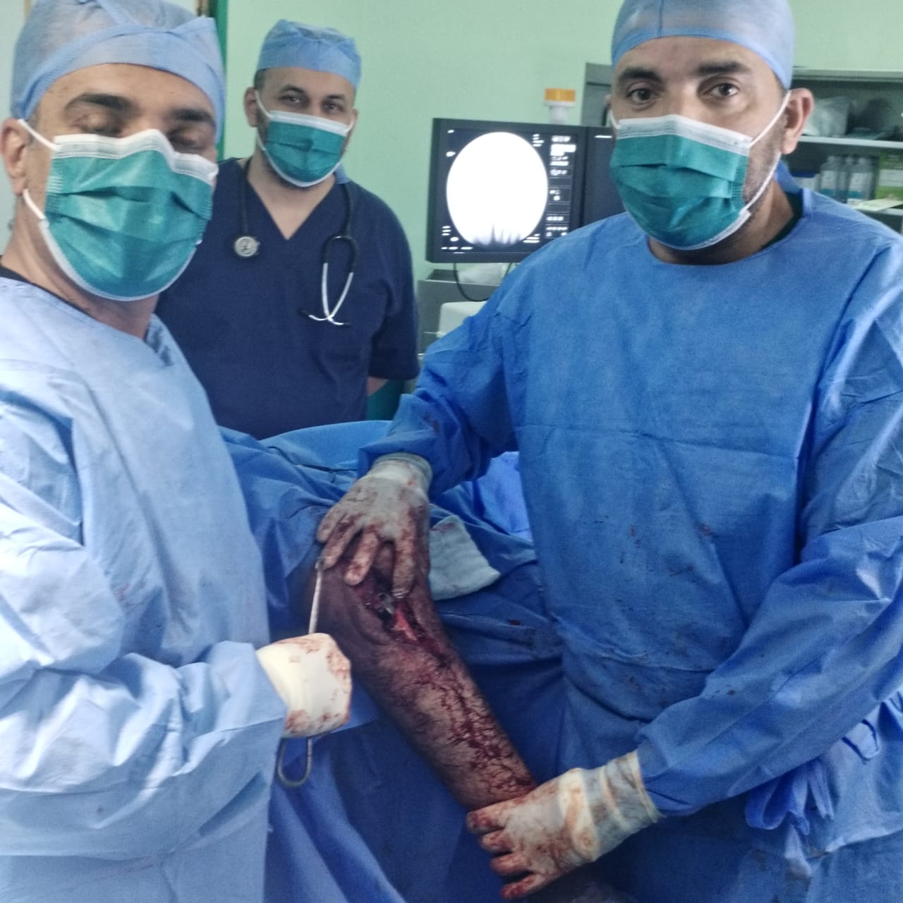 إنجاز طبي نوعي في مستشفى الزرقاء الحكومي