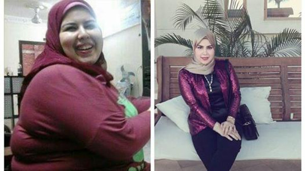 بالصور ..  فتاة مصرية تخسر نصف وزنها لتتجنب المضايقات
