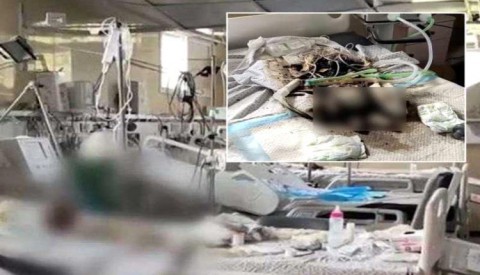 جثث رُضع متحللة على أسِرَّة مستشفى في غزة ..  بأي ذنب قتلوا؟