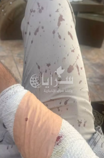 معلم يروي تفاصيل الاعتداء عليه داخل المسجد: "الطالب باغتني بالسيف أو المنشار والضربة كانت باتجاه وجهي"