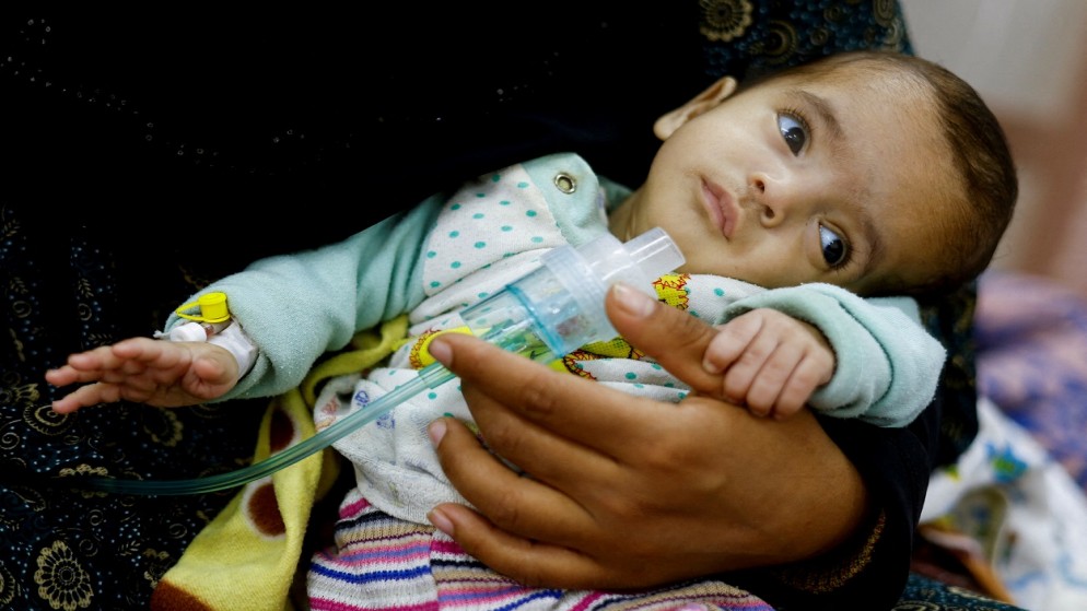 أطباء زاروا غزة يتحدثون عن "فظائع مروعة" : رأينا عظام وجوه الأطفال وهم أحياء 