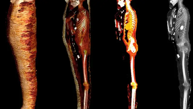 طفل ذهبي مصري عمره 2300 سنة ..  علماء يكشفون مفاجآت داخل جثته المحنطة! - صور 