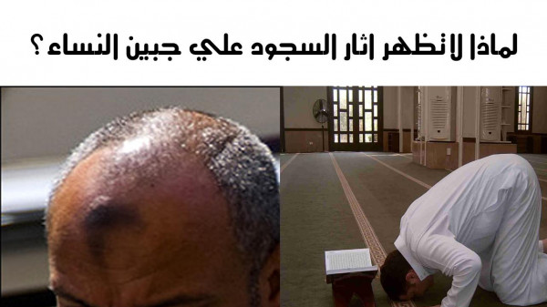 لماذا لا تظهر علامة السجود على جبين المرأة 
