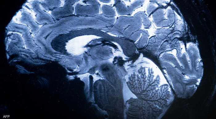 دراسة جديدة: مخ الانسان يغتسل أثناء النوم