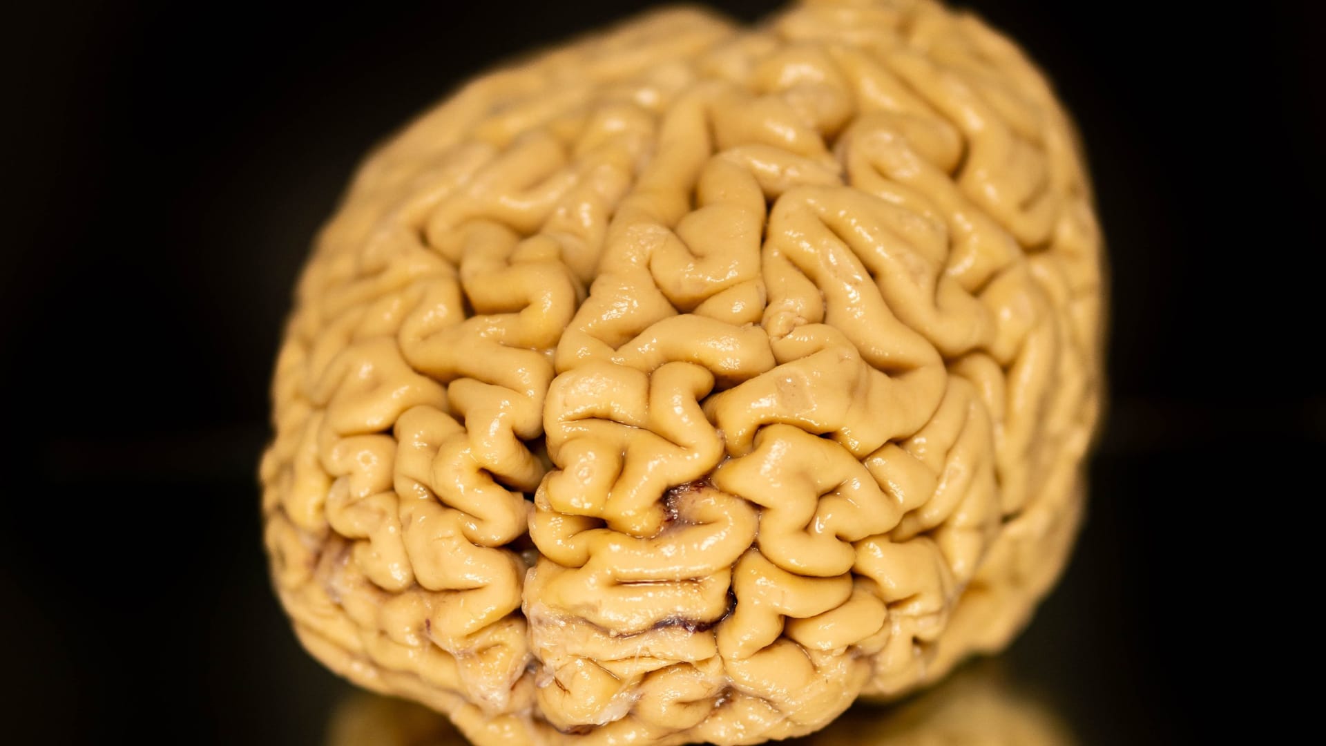 "خلايا شابة" في الثمانين تجعل المسنين المتميزين أكثر ذكاءً من الأربعينيين