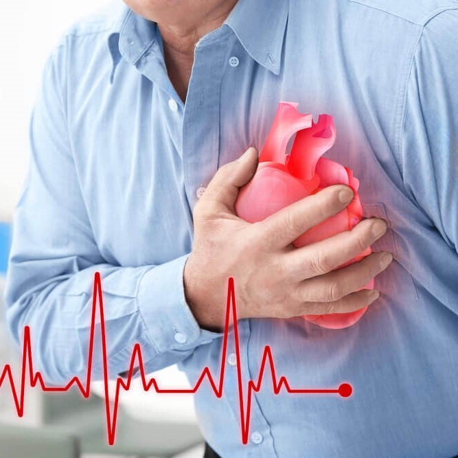 الإسعافات الأولية للنوبات القلبية