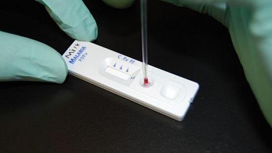 الصحة:شرائح الفحص الجديدة (Rapid test) أثبتت جدارتها في الأردن