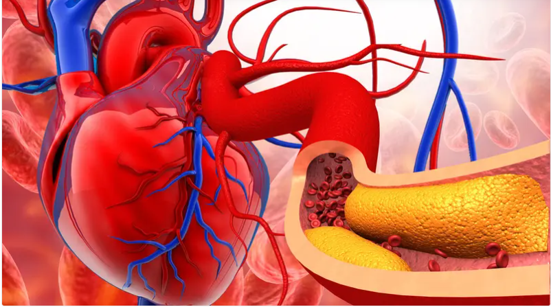 تقنية جديدة لفحص شرايين القلب دون تدخل معقد