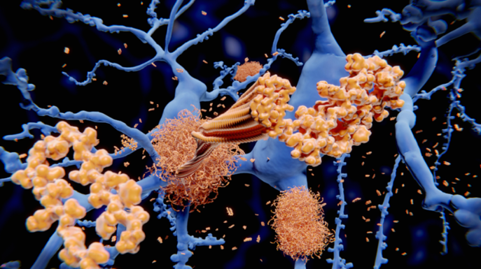 اكتشاف آلية خلوية تمنع تكوّن الألياف المرتبطة بألزهايمر