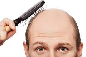 خليجي يهاجم طبيباً أثناء عملية زرع شعر