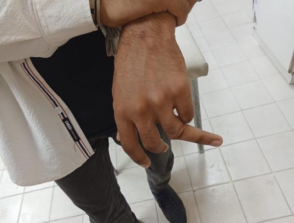 كسر في الاصبع ونزيف في الأنف  ..  معلم يعتدي على طالب بالضرب ويدخله المستشفى 