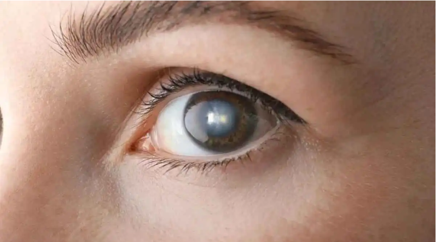 قاتل صامت للرؤية ..  كيف يهدد السكري سلامة العين؟