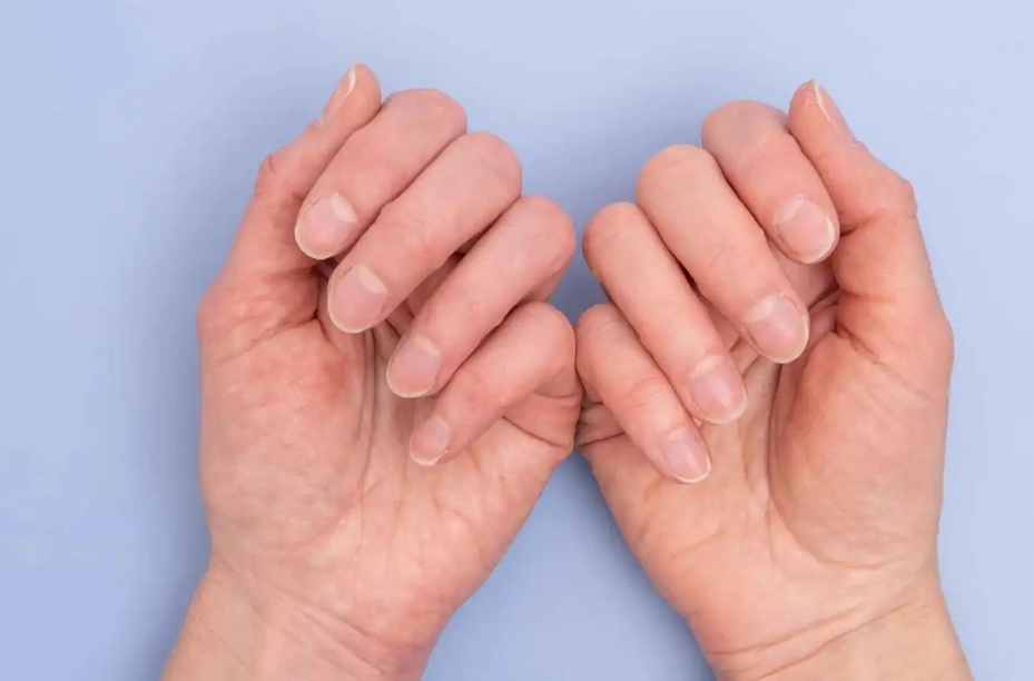 تغير شكل الأظافر قد يكون علامة مبكرة على قصور القلب   
