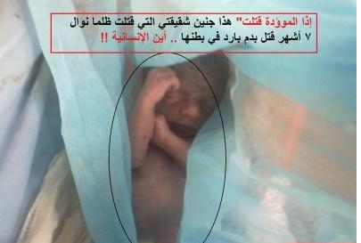 صور مؤلمة : "الجنين" المقتول في بطن المواطنة التي قتلتها "حماتها"