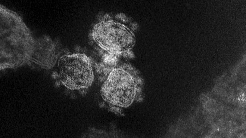 "اندماج أكثر من فيروس" ..  علماء يحلون لغز القدرة المضاعفة ألف مرة لـ"كوفيد-19" على إصابة الخلايا