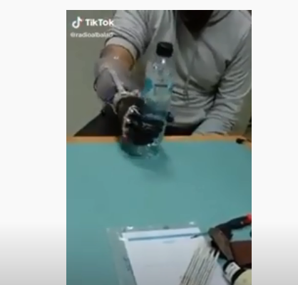 فيديو جديد لفتى الزرقاء صالح وهو يتدرب على استخدام الأطراف الصناعية و شرب المياه