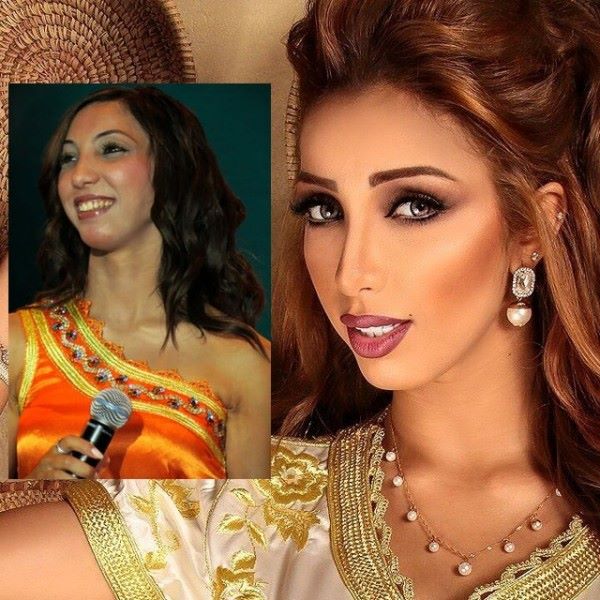 بالصور ..   كيف كانت دنيا بطمة قبل عمليات التجميل!!