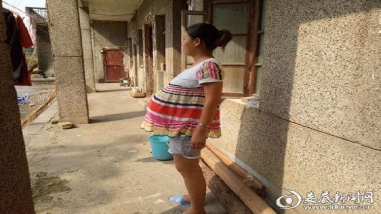 امرأة صينية تحمل جنينها 17 شهرا