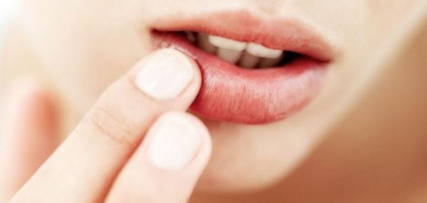 تعرفي على الأسباب الرئيسية لاسمرار الشفاه