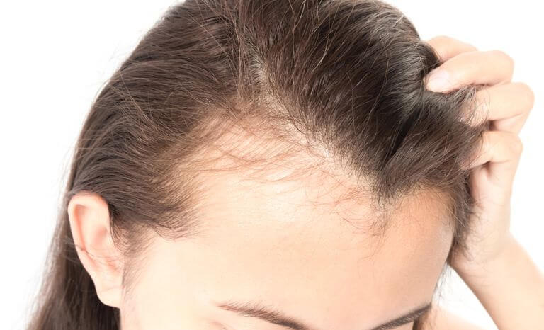 علاج ماليزي لملء فراغات الشعر في أسبوع