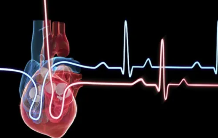 نصائح للوقاية من احتشاء عضلة القلب والجلطة الدماغية في الصيف