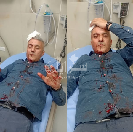 "الصحفيين" تدين الاعتداء على الزميل فارس حباشنة 