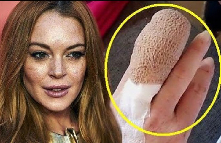 الممثلة الأمريكية ليندسي لوهان تفقد اصبعها في تركيا وأصدقاؤها يعثرون عليه