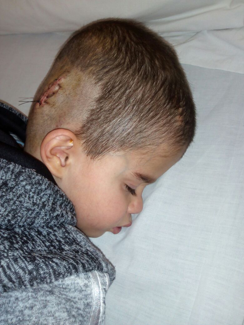 "براء "طفل يعاني من شلل دماغي ..  ويناشد اهل الخير للمساعدة باتمام علاجه