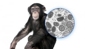 منظمة الصحة العالمية: جدري القرود يمكن احتوائه