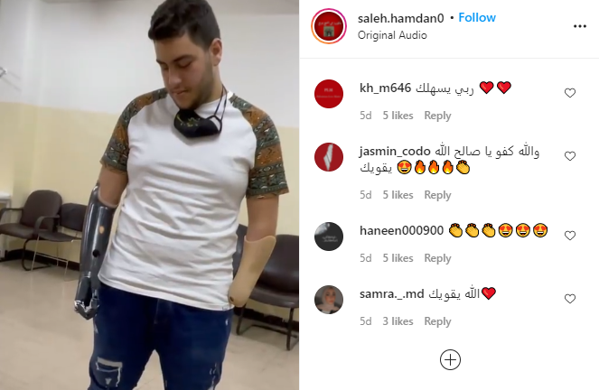 شاهدوا  ..  فيديو مؤثر لـ"فتى الزرقاء" صالح و هو يقوم بالتدريب على "الأطراف الإصطناعية"